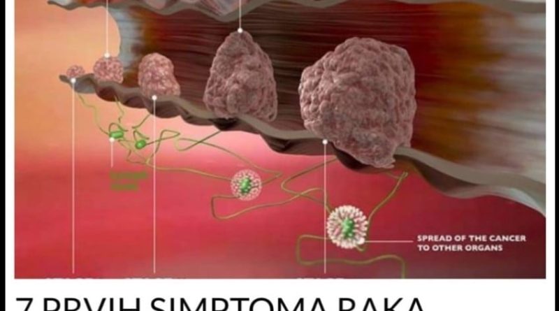 Prvih Simptoma Raka Debelog Crijeva Ljudi Ignori E Alarm Koji